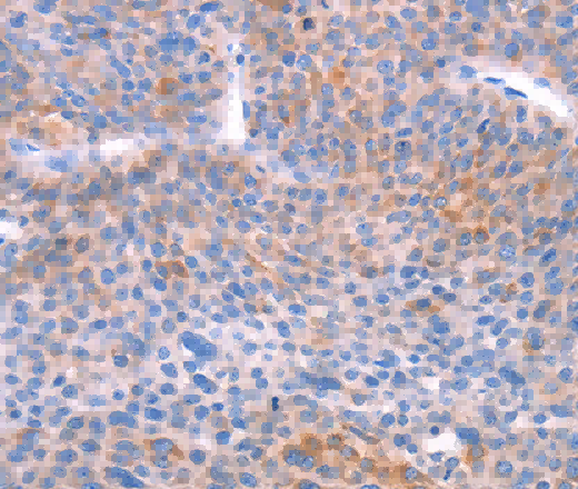 AADAC Polyclonal Antibody - 3
