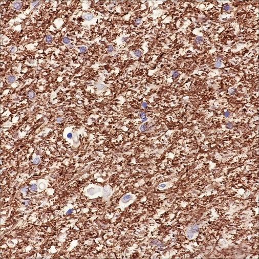 Recombinant MAG Monoclonal Antibody - 2