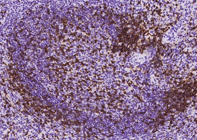 Recombinant CD3D & CD3E Monoclonal Antibody - small - 5