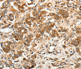 CALR Polyclonal Antibody - 3