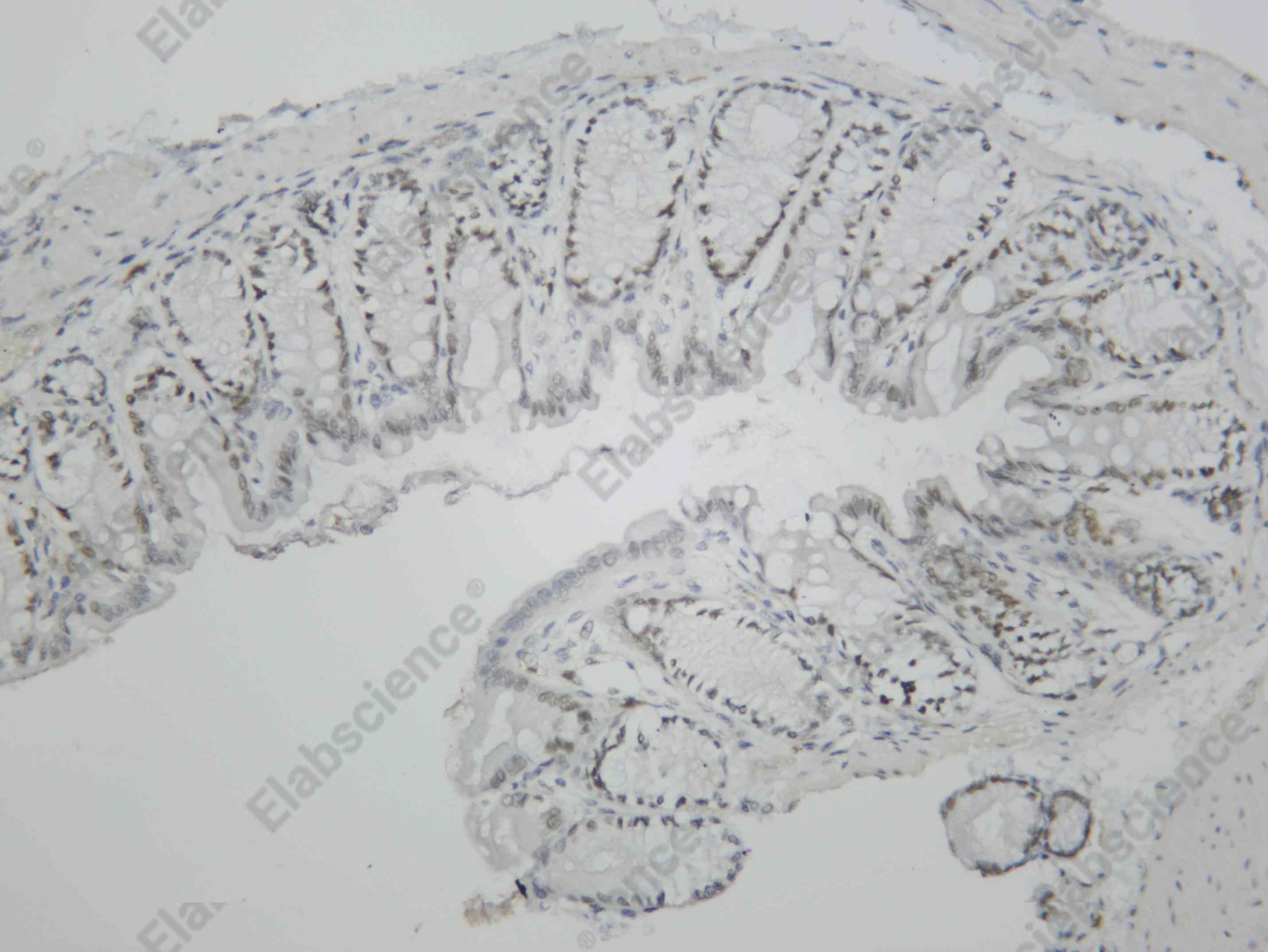 Recombinant ERR1 Monoclonal Antibody - 1