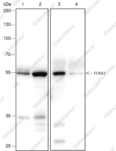 Recombinant FOXA1 Monoclonal Antibody - 1