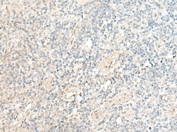 Immunohistochemistry of paraffin-embedded Human tonsil tissue  using SNRPD1 Polyclonal Antibody at dilution of 1:70(?200)