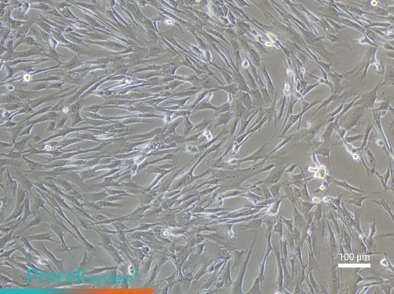 Human Uterine Fibroblast Complete Medium - 1